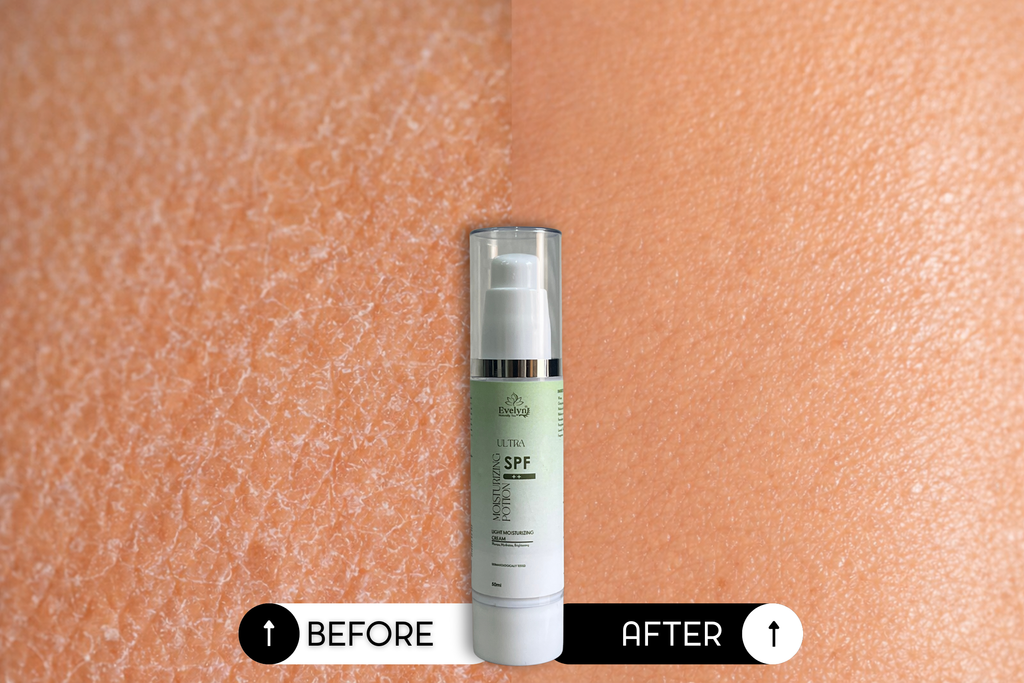 Ultra Moisturising Potion SPF++